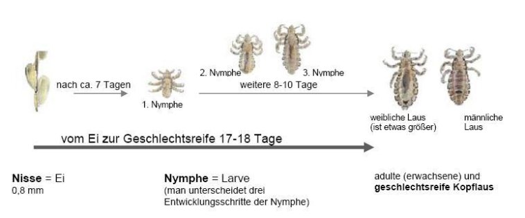 Die Entwicklung der Kopflaus (Darstellung)