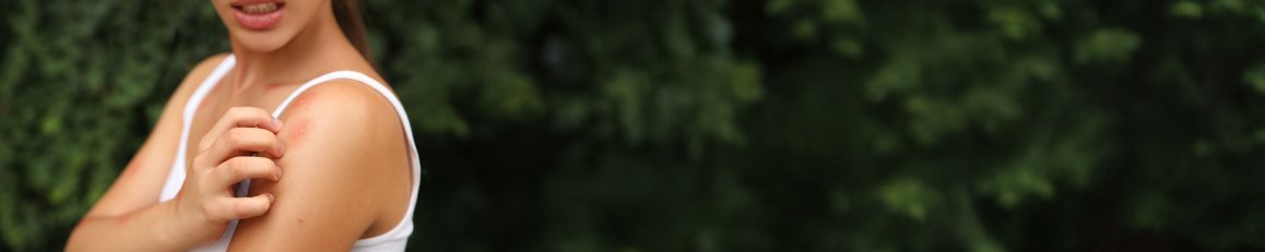 Woman scratching shoulder with insect bite outdoors, closeup