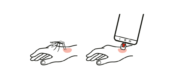 Anwendung mosquito by heat it Insekten-Stichheiler: Eine Mücke sticht in die Haut, und an die betroffene Stelle den Insektenstichheiler halten.
